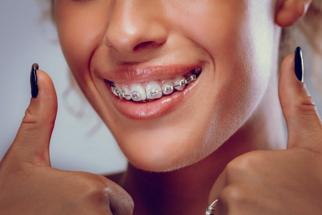 Choosing the Path to a Perfect Smile